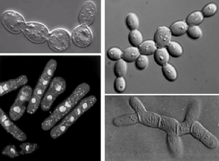 Células de levadura vistas al microscopio